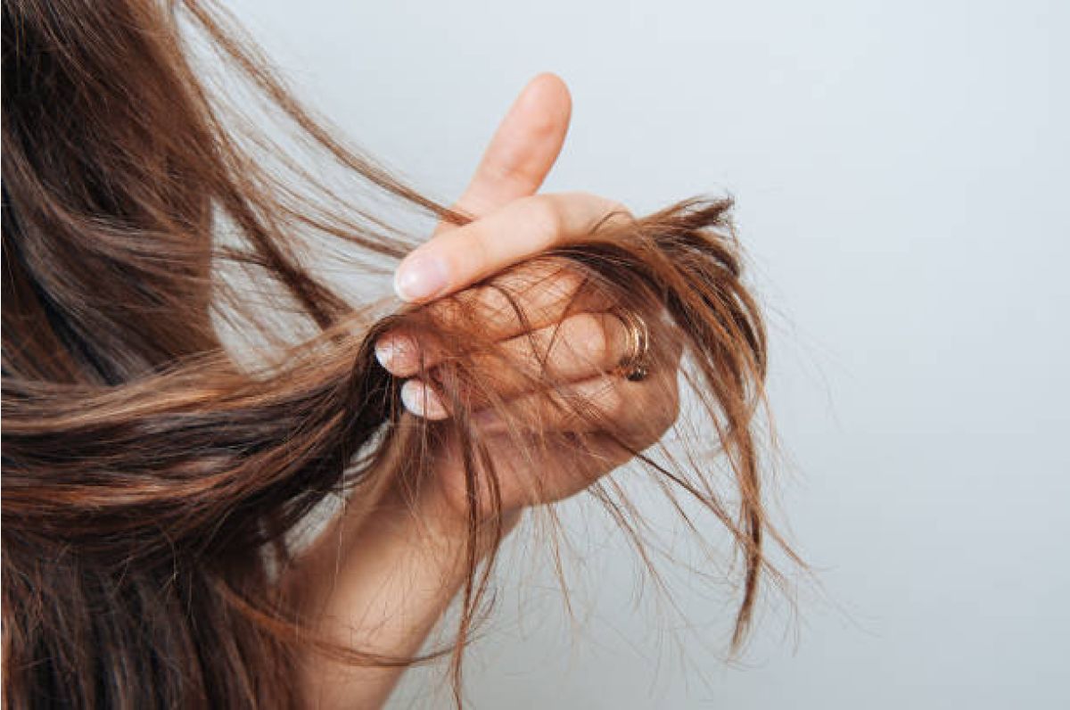 La chute des cheveux